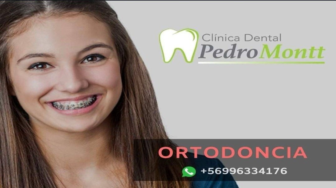 Tratamientos de Ortodoncia en Ancud